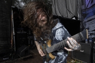 VULVODYNIA